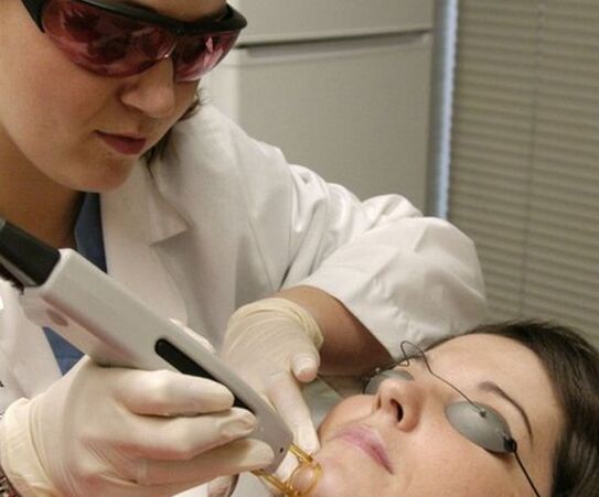 Procedimento a laser para rejuvenescimento da pele facial