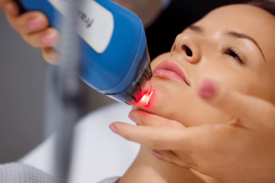 Rejuvenescimento a laser da pele facial