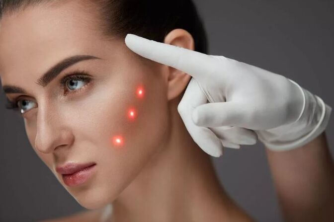 Rejuvenescimento a laser da pele