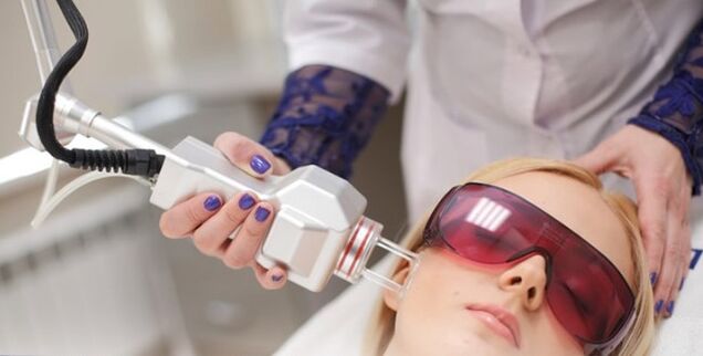 O princípio do rejuvenescimento do rosto com um laser